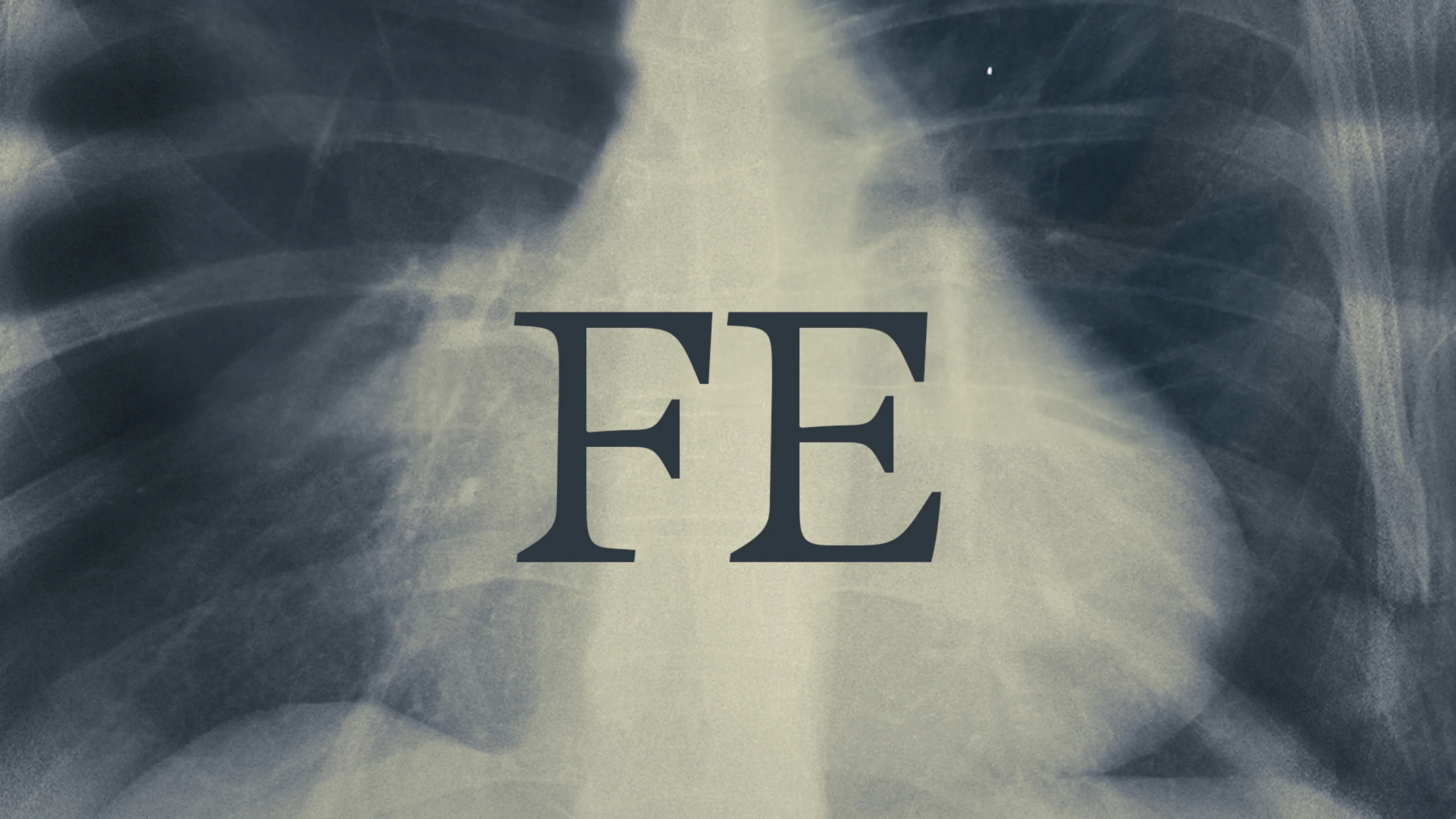 Fe poster